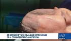 Esta innovadora tecnología médica permite devolver la calidad de vida a pacientes diagnosticados con enfermedades catastróficas. Un reportaje de Ericka Vera
