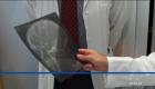 La investigadora ecuatoriana y su equipo multidisciplinario trabajan en el desarrollo de una terapia pionera para combatir la enfermedad. Un reportaje de Mishell Villacís
