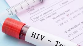 El Virus de Inmunodeficiencia Humana, es un virus que ataca el sistema inmunológico del cuerpo.