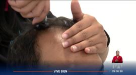 La alopecia es la pérdida de cabello. Esta afección puede presentarse tanto en hombres como en mujeres. Atención porque las causas pueden ser varias, pero una de ellas es el estrés.

Un reportaje de Stephany Paz