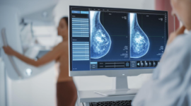 La detección temprana del cáncer de mama es clave para la supervivencia del paciente.