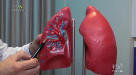 En esTAmañana te explicamos sobre esta enfermedad silenciosa que puede ser fatal si no se controla a tiempo.