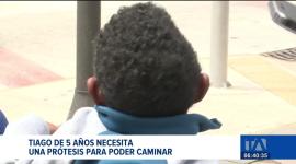 Tiago, un niño de cinco años, necesita una prótesis para mejorar su calidad de vida. Su familia asegura que el dispositivo cuesta cerca de siete mil dólares, un valor que no pueden cubrir por cuenta propia.

Un reportaje de Juan Miguel Rodríguez