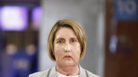 Carmen es la primera paciente en recibir un trasplante de cara de una donante que recibió una eutanasia,