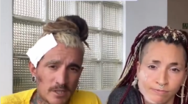 El exfutbolista argentino Gastón Firpo resultó herido en volcamiento de bus en Ecuador.