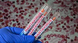 El hantavirus se contagia por las excretas del ratón contaminado, pero la cepa de los Andes se trasmite entre seres humanos.