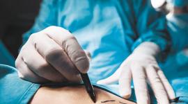 Familia denuncia que mujer quedó en coma inducido tras cirugía estética en Quito.