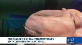 Esta innovadora tecnología médica permite devolver la calidad de vida a pacientes diagnosticados con enfermedades catastróficas. Un reportaje de Ericka Vera