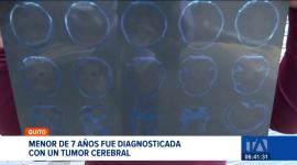 Los familiares de una niña de 7 años, diagnosticada con tumor cerebral, piden las autoridades el traslado y derivación urgente a Solca. Un reportaje de Nathalie Jiménez