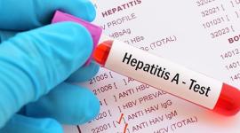 El virus de la Hepatitis A se propaga al ingerir agua o alimentos contaminados.