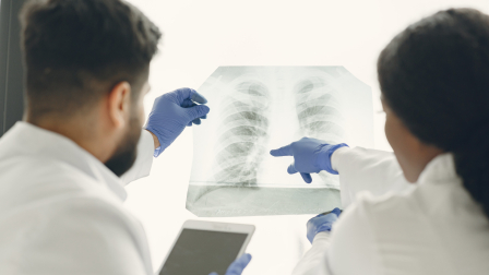 En 2020, se estimó que hubo 2,2 millones de nuevos casos de cáncer de pulmón y 1,8 millones de muertes por esta enfermedad en todo el mundo.