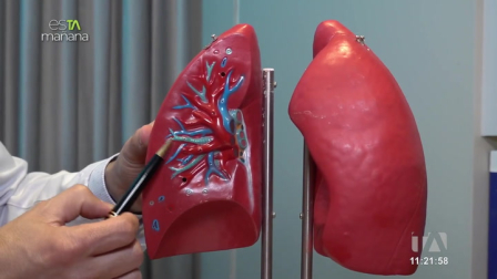 En esTAmañana te explicamos sobre esta enfermedad silenciosa que puede ser fatal si no se controla a tiempo.