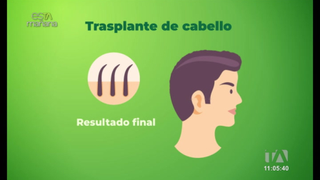 El especialista Juan Esteban Arízaga nos explica qué es la alopecia, una enfermedad que afecta la confianza de hombre y mujeres. Además, de tratamientos efectivos.