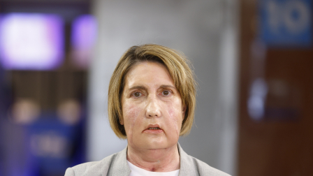 Carmen es la primera paciente en recibir un trasplante de cara de una donante que recibió una eutanasia,