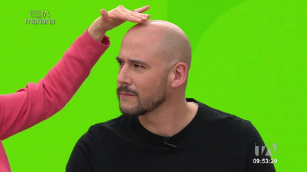 Jenny Hernández, especialista capilar, nos contó cuales son los factores que generan esta condición y cómo detectarla a tiempo.