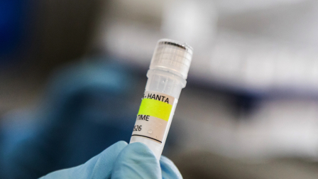 Un científico del Instituto Malbrán sostiene un recipiente utilizado para diagnosticar el hantavirus andino