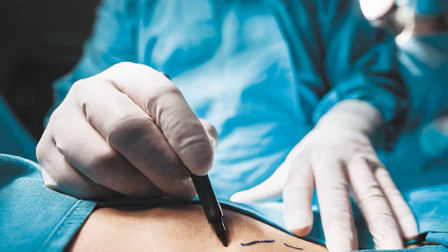 Familia denuncia que mujer quedó en coma inducido tras cirugía estética en Quito.
