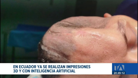 Esta innovadora tecnología médica permite devolver la calidad de vida a pacientes diagnosticados con enfermedades catastróficas. Un reportaje de Ericka Vera
