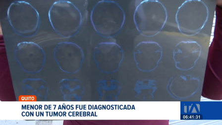 Los familiares de una niña de 7 años, diagnosticada con tumor cerebral, piden las autoridades el traslado y derivación urgente a Solca. Un reportaje de Nathalie Jiménez