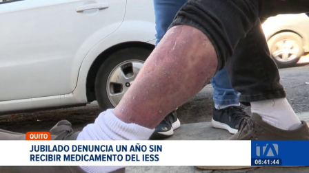 Un hombre jubilado que padece una enfermedad catastrófica denunció que el IESS no le provee su tratamiento desde hace un año. Un reportaje de Juan Miguel Rodríguez