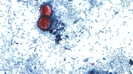 Estados Unidos registra un aumento de casos de Cyclospora