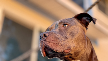 Víctima de ataque de pitbull en el centro de Quito denuncia abandono del dueño y del Municipio