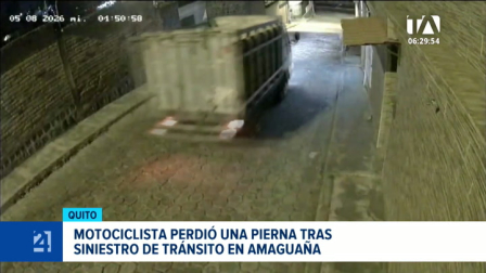 El siniestro vial dejó severas secuelas físicas en la víctima, quien responsabiliza a la maniobra imprudente del conductor del pesado automotor. Un reportaje de Juan Miguel Rodríguez
