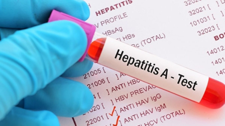 El virus de la Hepatitis A se propaga al ingerir agua o alimentos contaminados.