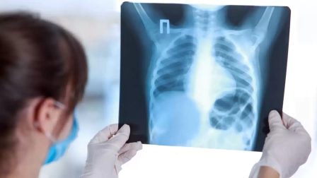 El MSP recomienda aplicar medidas preventivas y vigilar posibles síntomas de tuberculosis en los planteles educativos para proteger a estudiantes y docentes.