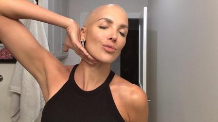 María Teresa, 'la flaca', Guerrero ha mostrado activamente su lucha contra el cáncer en redes sociales.
