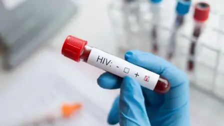 El VIH se diagnostica a través de pruebas de laboratorio que detectan anticuerpos o antígenos del virus en la sangre.