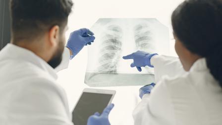 En 2020, se estimó que hubo 2,2 millones de nuevos casos de cáncer de pulmón y 1,8 millones de muertes por esta enfermedad en todo el mundo.