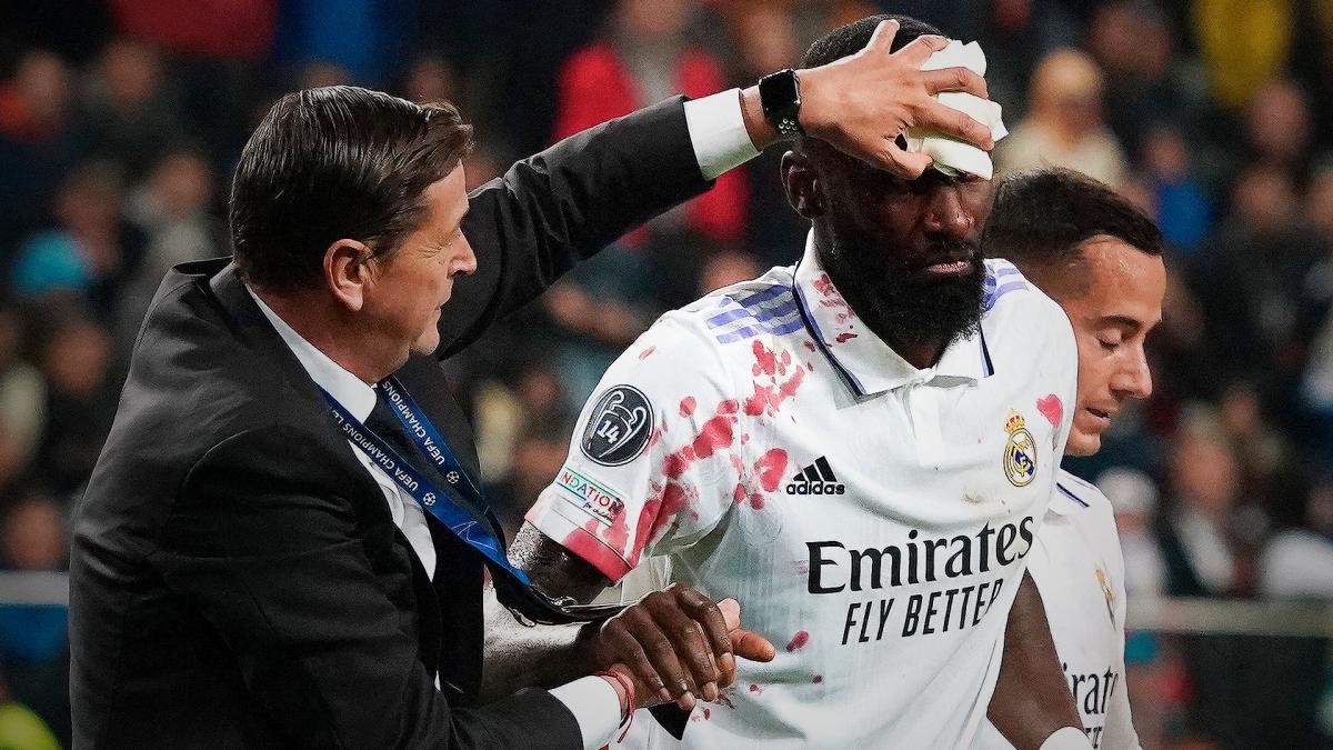 El Real Madrid logra un punto con sangre y firma el pase a octavos de ...